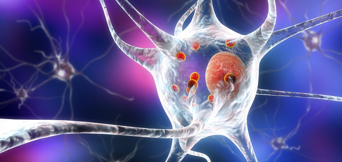 Gesundheitsvortrag Sekundärprophylaxe Schlaganfall Anne Jungbäck 20251101 Bild